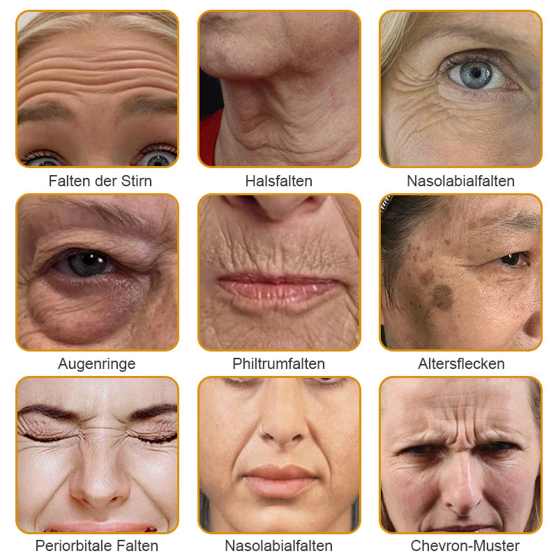 🐝🍀Hergestellt in Deutschland - ✨NEGUSY™ Botox Bienenvenom Faltenentfernungscreme