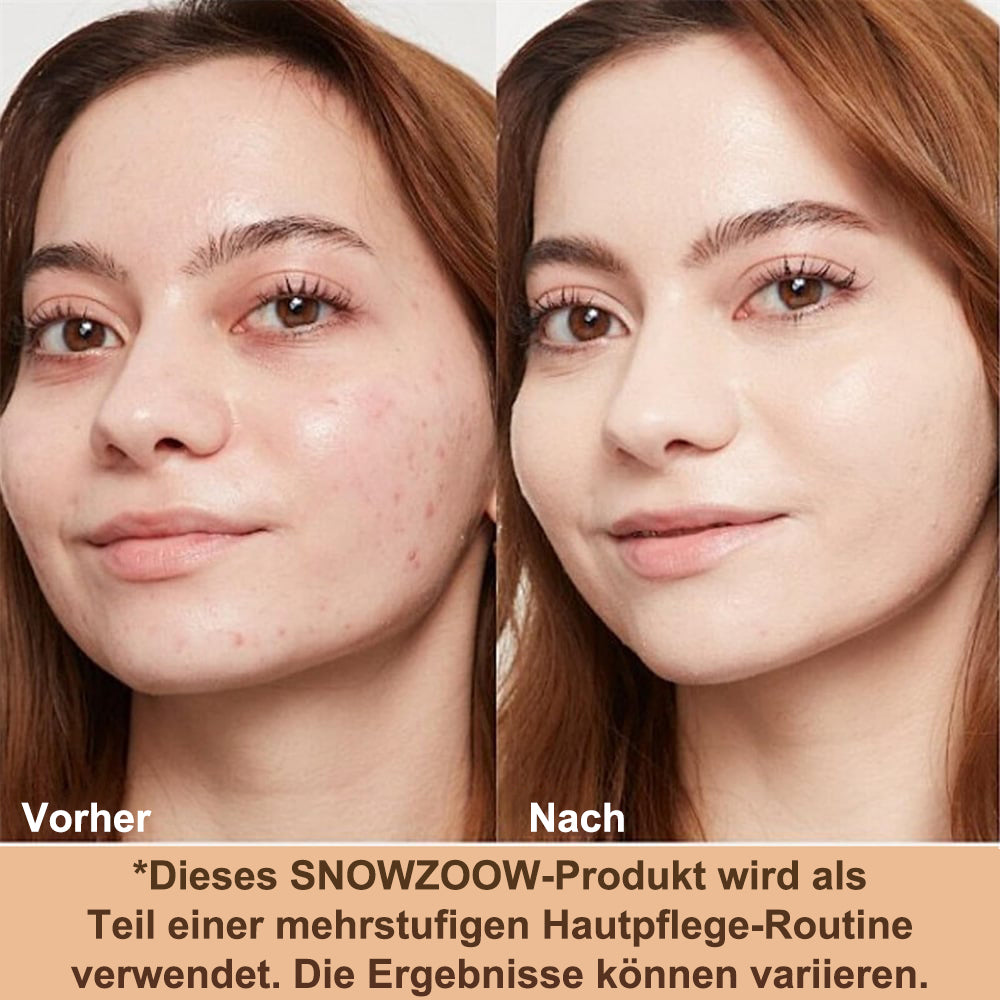 🔥 Make-up Foundation 4-in-1 – mittlere Deckkraft