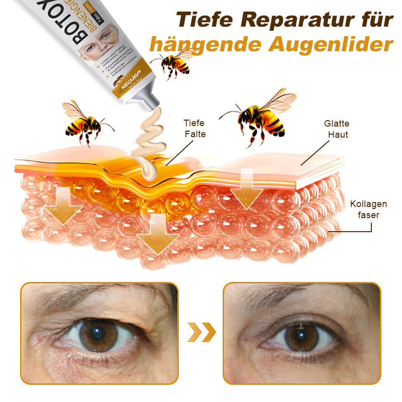 🐝🍀Hergestellt in Deutschland - ✨NEGUSY™ Botox Bienenvenom Faltenentfernungscreme