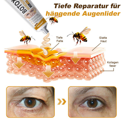 🐝🍀Hergestellt in Deutschland - ✨NEGUSY™ Botox Bienenvenom Faltenentfernungscreme