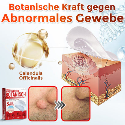 ✅ ODALIT® Mikronadel-Botanisches Hautanhängsel-Entfernungspflaster 🇩🇪 Hergestellt in Deutschland